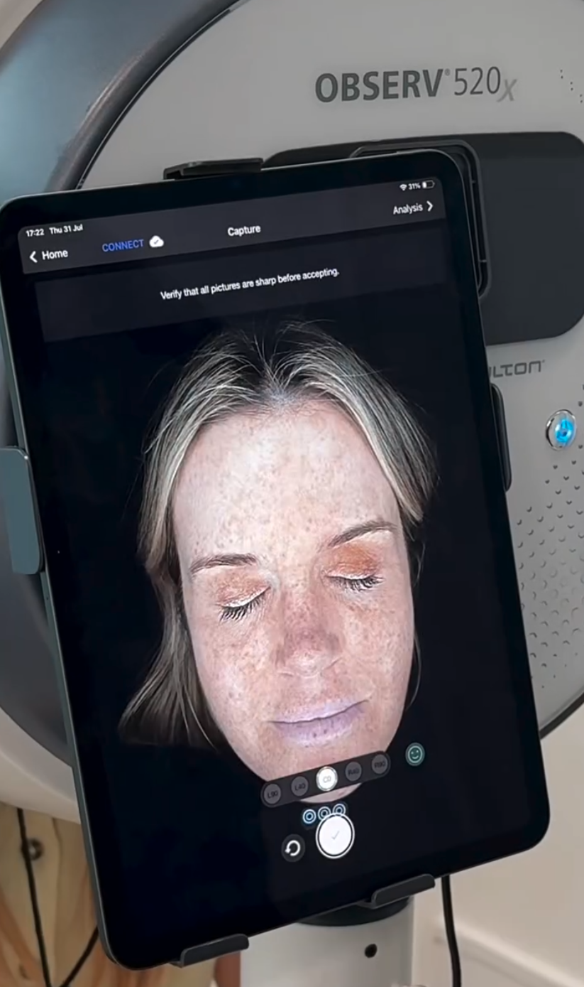 Observ520 Skin Analysis - Revealing skin conditions beneath the surface